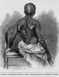 Esclave brle et torture par sa matresse, Richmond, Virginie, E.U, 1866.