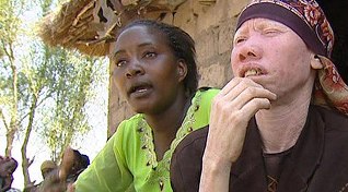 Une personne albinos en Tanzanie