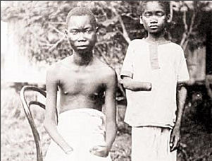 Les dgts causs par la colonisation belge au Congo